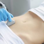 Doctor's hands on a woman's stomach, ultrasound of the abdominal cavity, close-up. Diagnosis of diseases of the genitourinary system